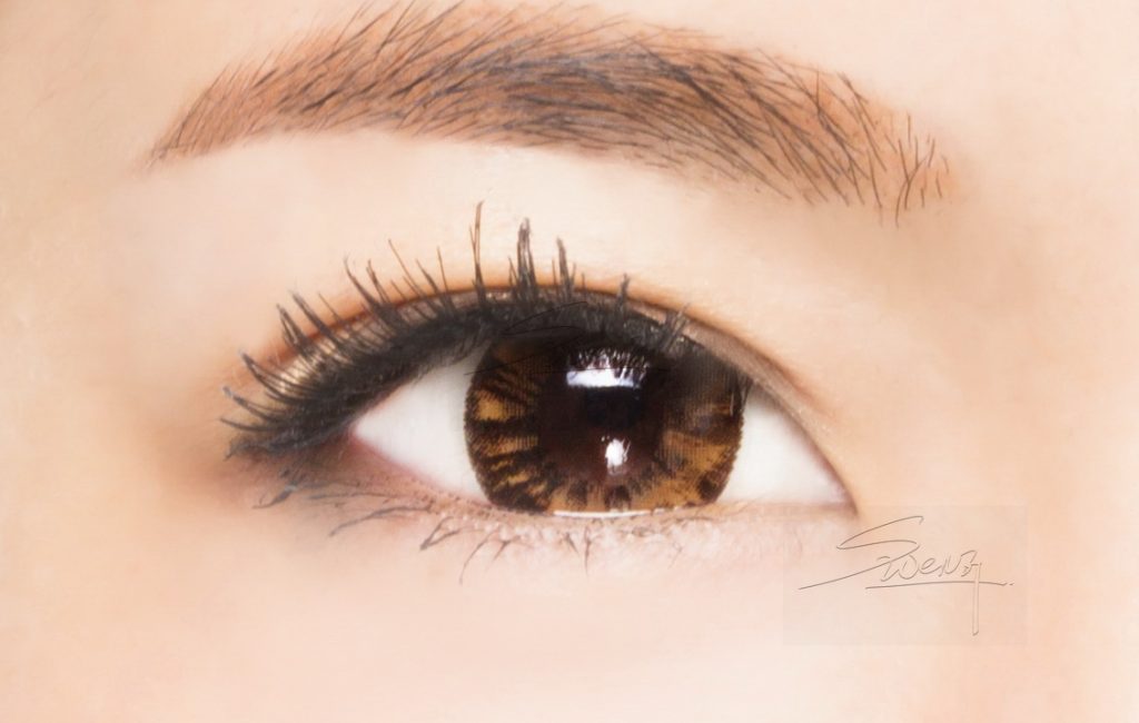 Upper eyelid - Low in-fold - Blepharoplasty - Double eyelid surgery