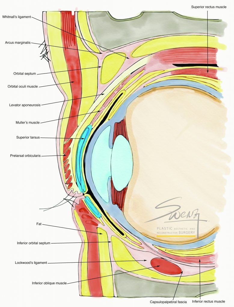 Eye Cross Section - Droopy Eyelid - Blepharoplasty - Ptosis Correction