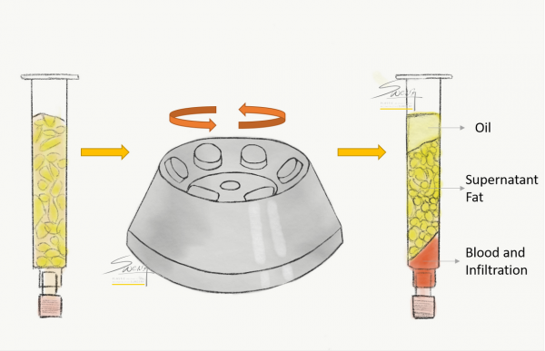 Centrifugation to separate fats harvested